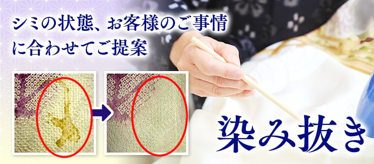 シミの状態、お客様のご事情に合わせてご提案